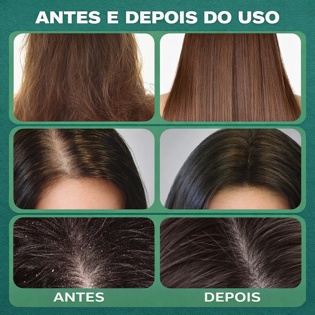 Nature Green™ - Shampoo Detox Natural