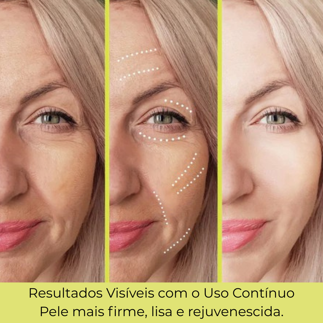 Creme Coreano de Retinol para Olhos – Compre 1 Leve 3